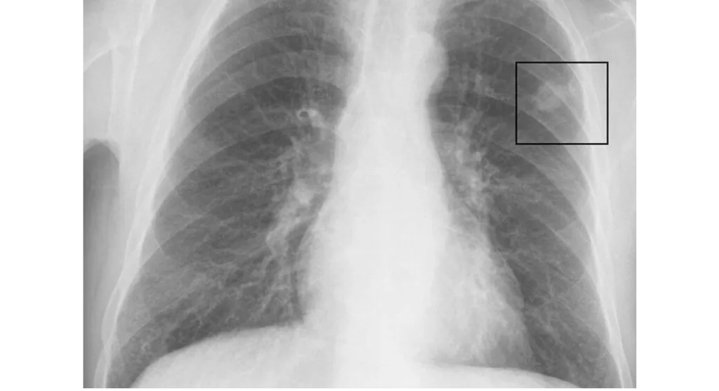 Dược Bình Đông